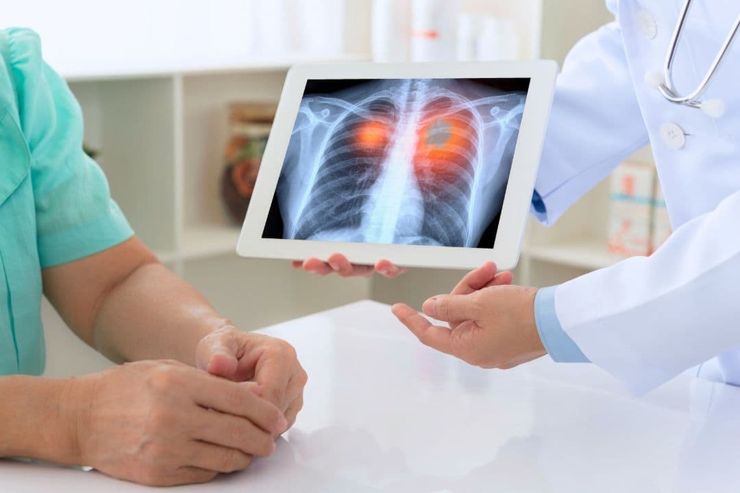Investigadores de la UFV participan en un estudio sobre biomarcadores que podrían mejorar la detección temprana del cáncer de pulmón | UFV 240614_portada-deteccion-temprana-cancer-de-pulmon Investigadores de la UFV participan en un estudio sobre biomarcadores que podrían mejorar la detección temprana del cáncer de pulmón | UFV Estudiar en Universidad Privada Madrid