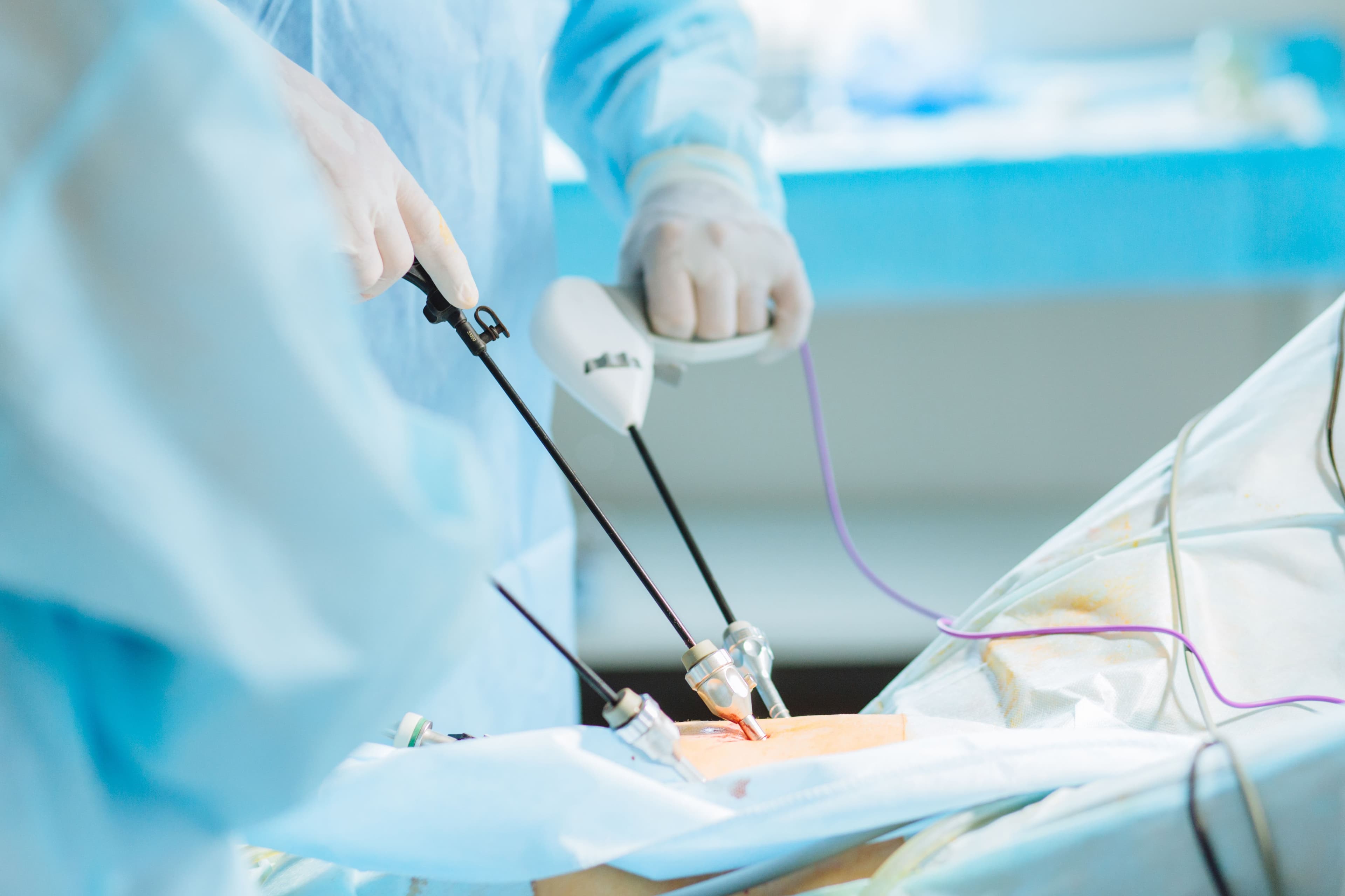 Título Experto en Cirugía Robótica y Laparoscópica en Urología: Cirugía Prostática, Renal y Vesical Experto en Cirugia Laparoscopica Toracoscopica y Robotica_IMAGEN Título Experto en Cirugía Robótica y Laparoscópica en Urología: Cirugía Prostática, Renal y Vesical Estudiar en Universidad Privada Madrid